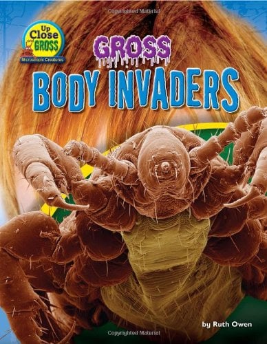 Gross Body Invaders (Up Close and Gross: Microscopic Creatures)