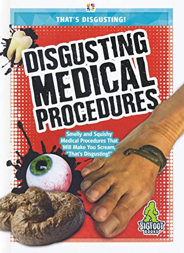 Disgusting Medical Procedures (That's Disgusting!)